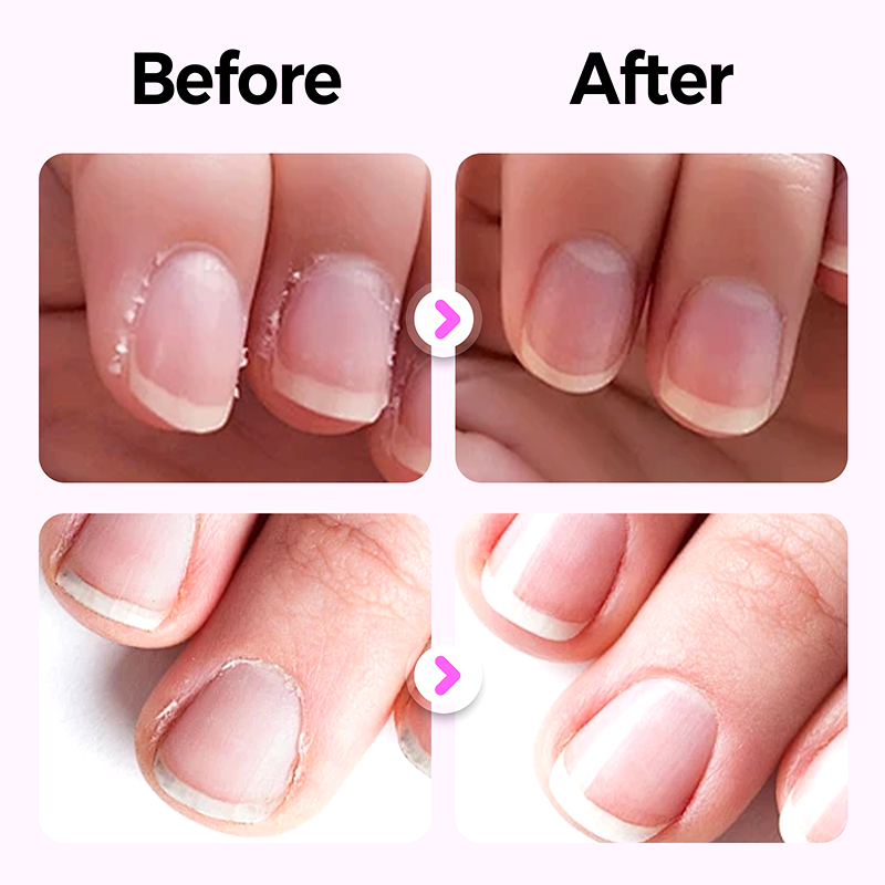 💜Köp mer spara mer💜 3-i-1 nagelvårdspenna💅