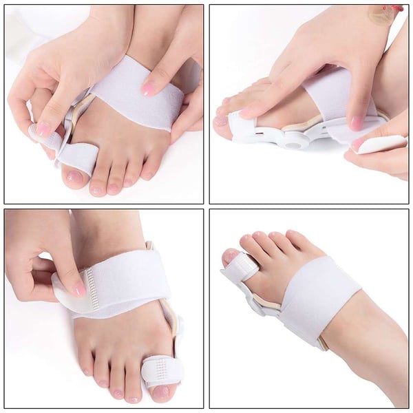 🔥Hot SALE- 【Läkare Rekommenderad】 Bunion Corrector för män och kvinnor