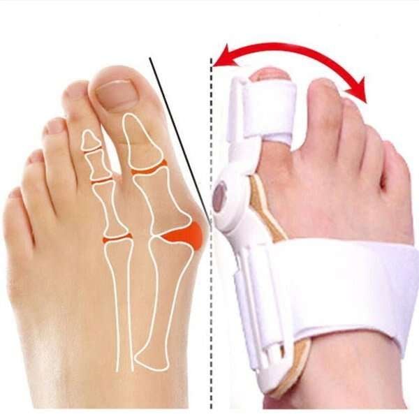 🔥Hot SALE- 【Läkare Rekommenderad】 Bunion Corrector för män och kvinnor